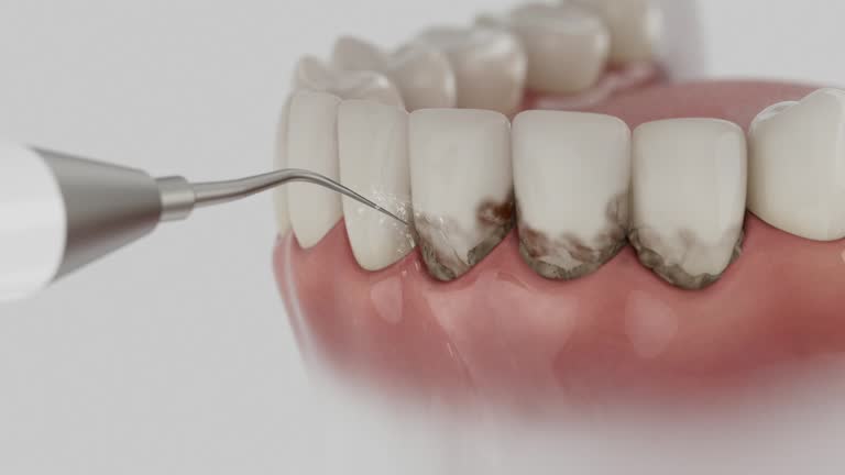 Trusted Tooth Extraction service in North Browning, MT - Dentist Open Now